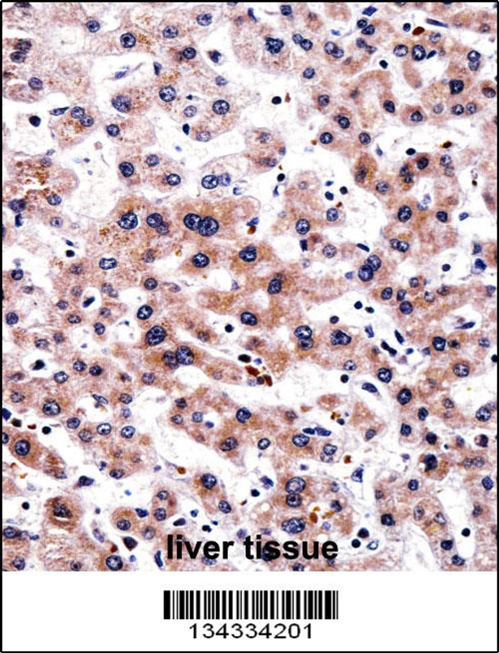 RCAN3 Antibody immunohistochemistry analysis in formalin fixed and paraffin embedded human liver tissue followed by peroxidase conjugation of the secondary antibody and DAB staining.