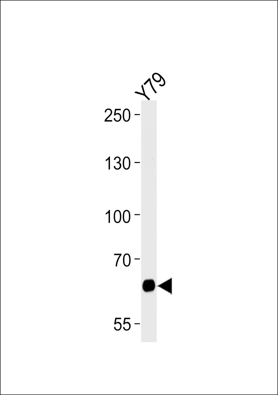 Western blot analysis of lysate from Y79 cell line, using PPEF2 Antibody at 1:1000 at each lane.
