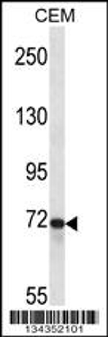 Western blot analysis in CEM cell line lysates (35ug/lane) .