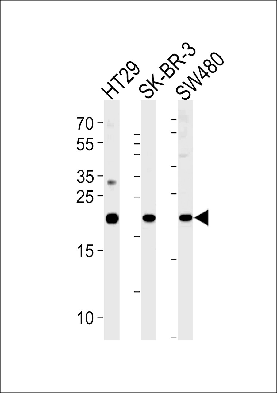 Western blot analysis in HT29, SK-BR-3, SW480 cell line lysates (35ug/lane) .