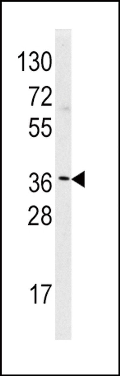 Western blot analysis of HNMT Antibody in Hela cell line lysates (35ug/lane) . HNMT was detected using the purified polyclonal antibody.