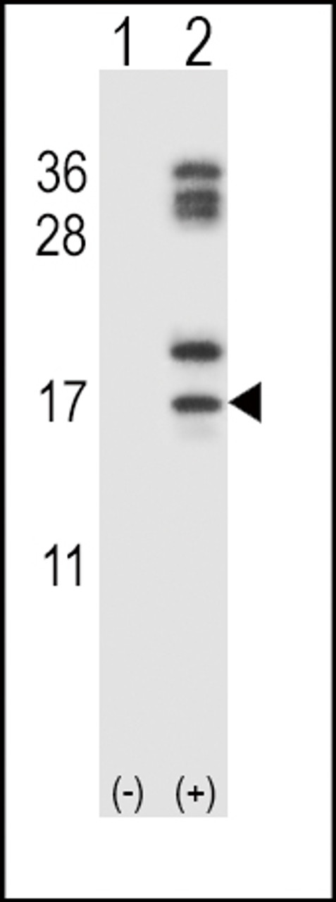 Western blot analysis of CLC using rabbit polyclonal CLC Antibody using 293 cell lysates (2 ug/lane) either nontransfected (Lane 1) or transiently transfected (Lane 2) with the CLC gene.