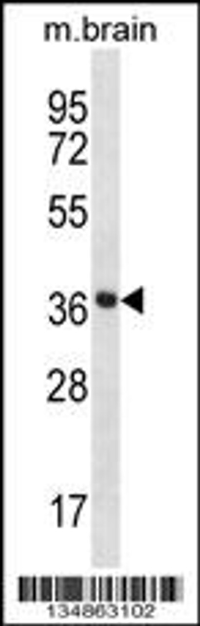 Western blot analysis in mouse brain tissue lysates (35ug/lane) .This demonstrates the Prkaca/Prkacb antibody detected the Prkaca/Prkacb protein (arrow) .