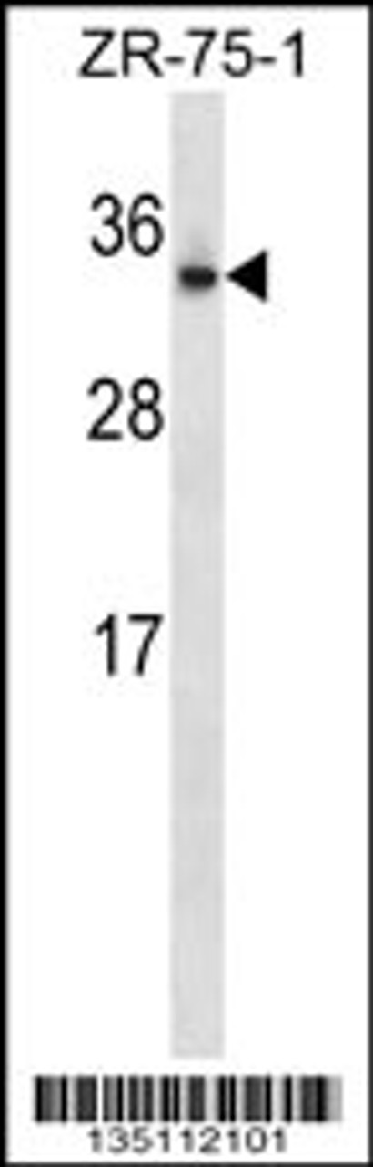 Western blot analysis in ZR-75-1 cell line lysates (35ug/lane) .