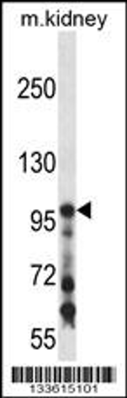 Western blot analysis in mouse kidney tissue lysates (35ug/lane) .