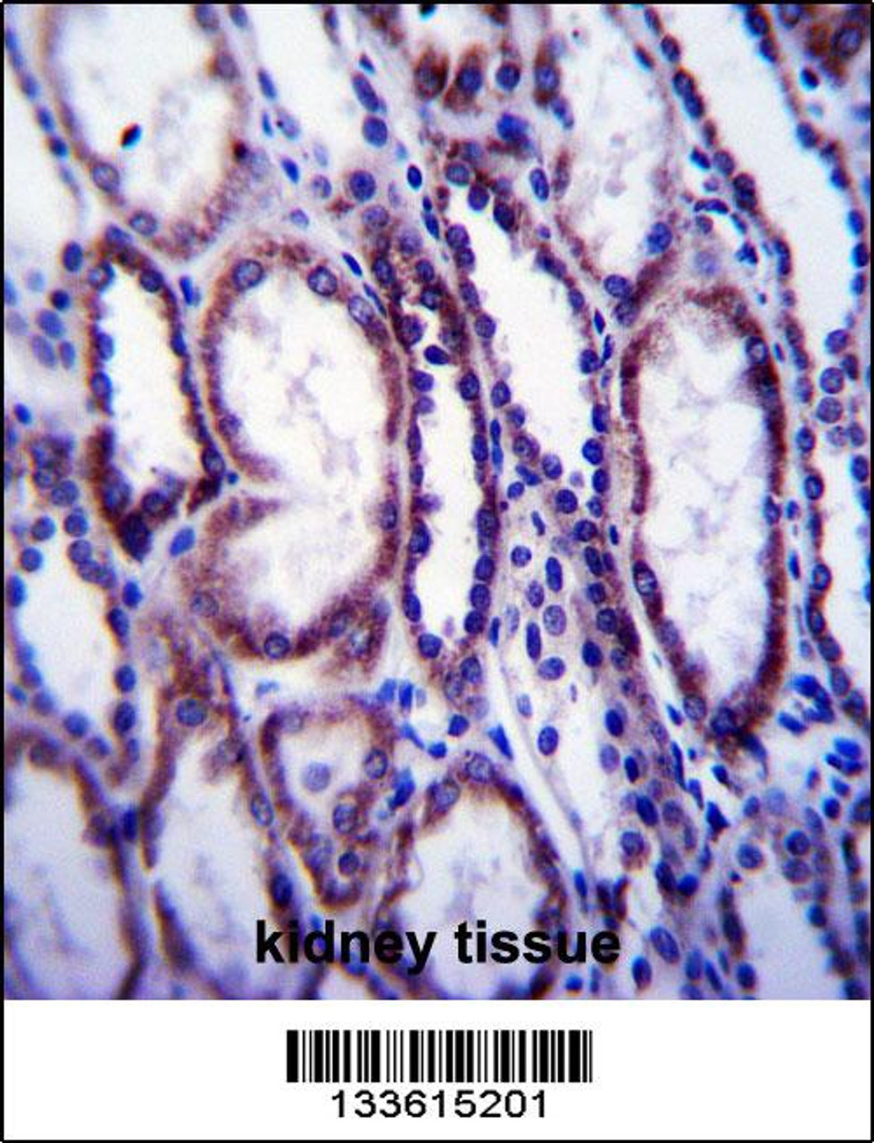 COL1A1 Antibody immunohistochemistry analysis in formalin fixed and paraffin embedded human kidney tissue followed by peroxidase conjugation of the secondary antibody and DAB staining.