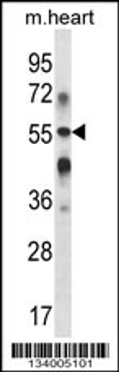 Western blot analysis in mouse heart tissue lysates (35ug/lane) .