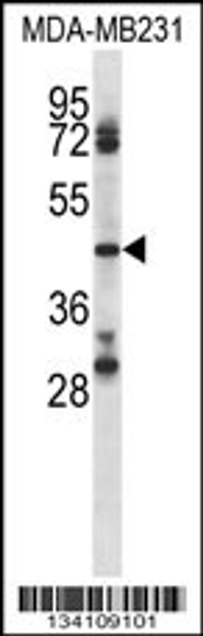 Western blot analysis in MDA-MB231 cell line lysates (35ug/lane) .