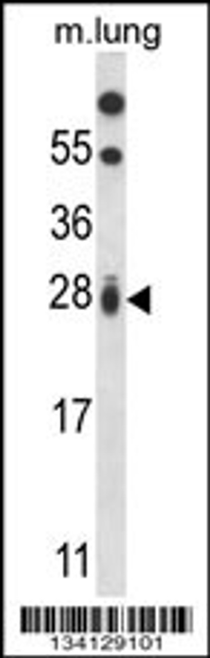 Western blot analysis in mouse lung tissue lysates (35ug/lane) .