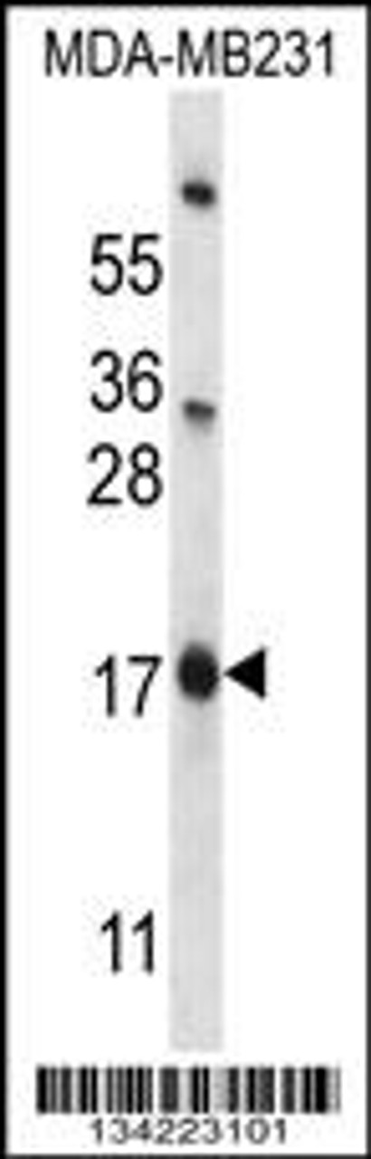 Western blot analysis in MDA-MB231 cell line lysates (35ug/lane) .