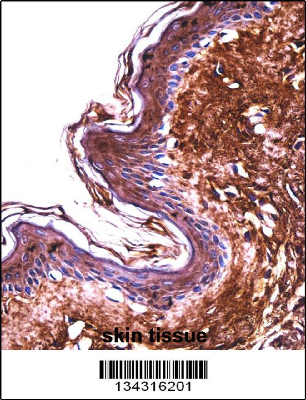 PPT2 Antibody immunohistochemistry analysis in formalin fixed and paraffin embedded human skin tissue followed by peroxidase conjugation of the secondary antibody and DAB staining.