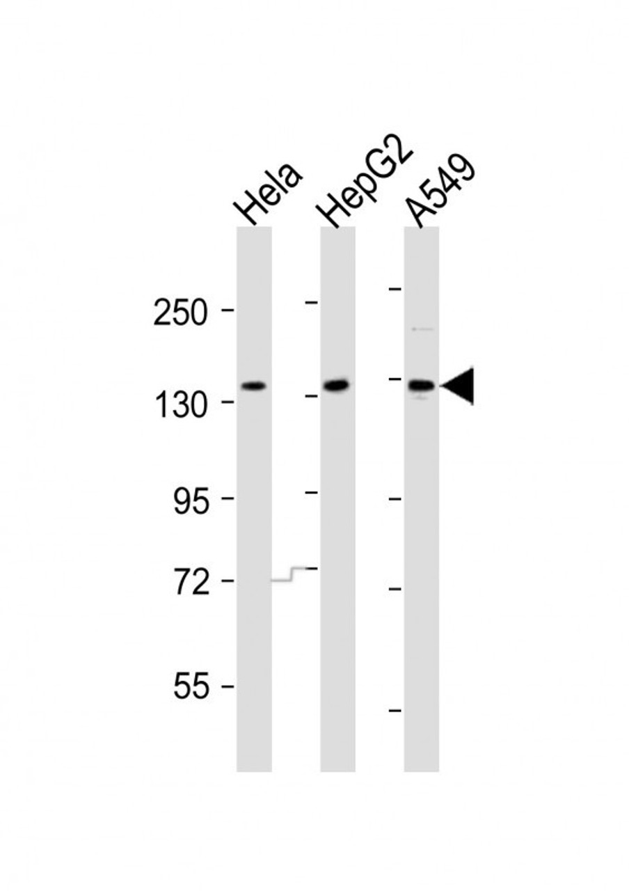 Western Blot at 1:2000 dilution Lane 1: Hela whole cell lysates Lane 2: HepG2 whole cell lysates Lane 3: A549 whole cell lysates Lysates/proteins at 20 ug per lane.