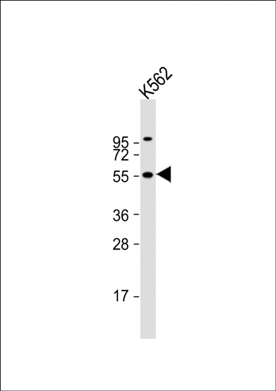 Western Blot at 1:1000 dilution + K562 whole cell lysate Lysates/proteins at 20 ug per lane.