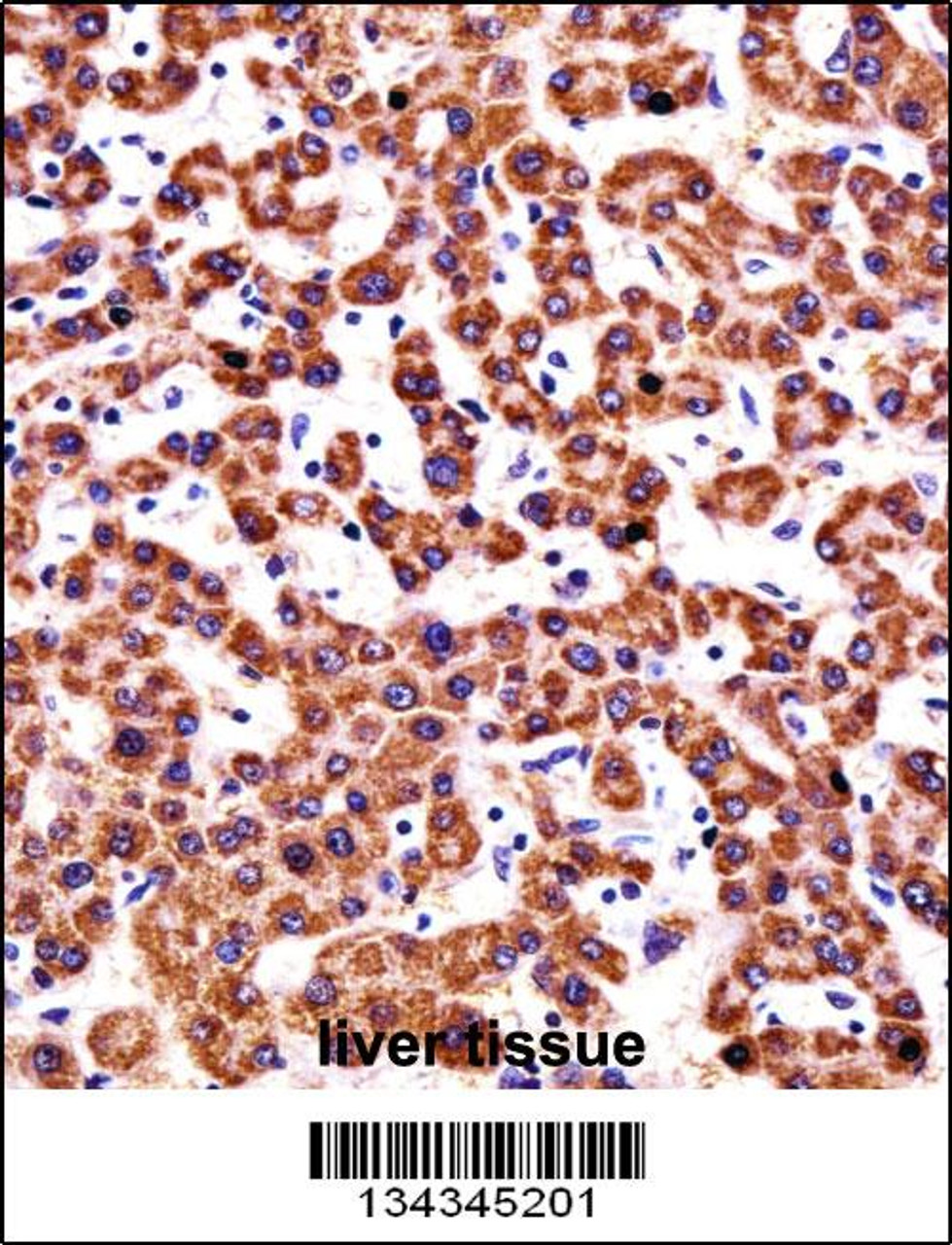 CYP2D6 Antibody immunohistochemistry analysis in formalin fixed and paraffin embedded human liver tissue followed by peroxidase conjugation of the secondary antibody and DAB staining.