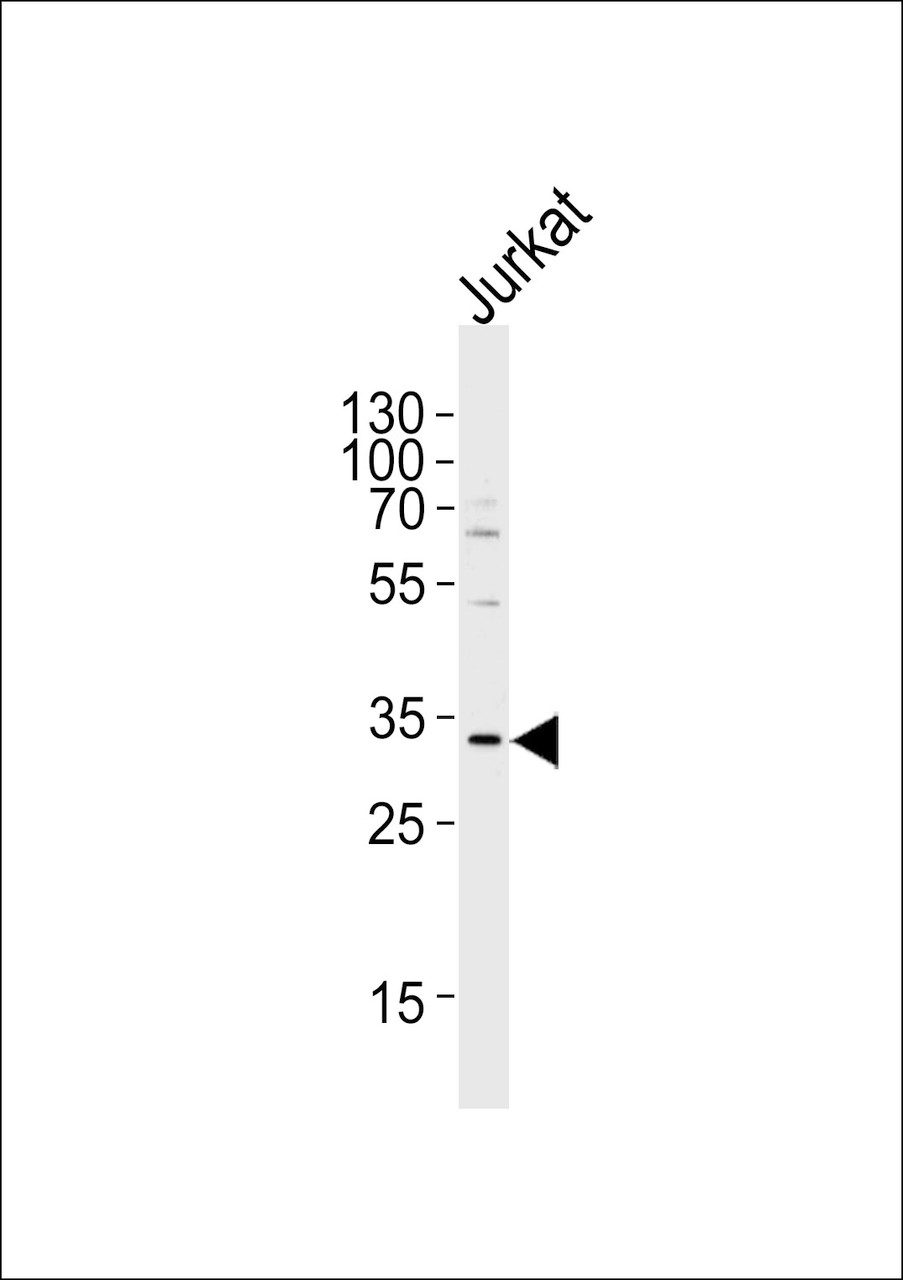 Western blot analysis of lysate from Jurkat cell line, using OSM Antibody at 1:1000 at each lane.