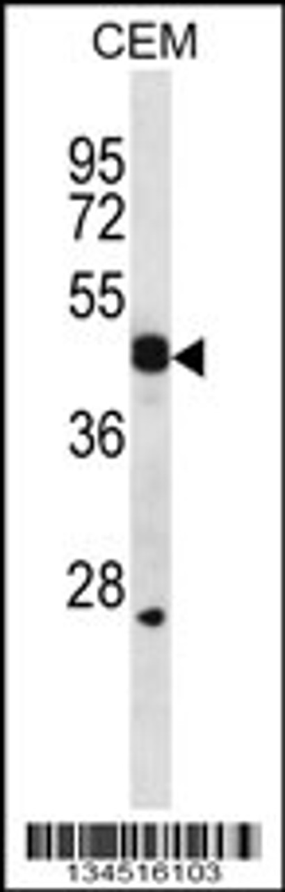 Western blot analysis in CEM cell line lysates (35ug/lane) .