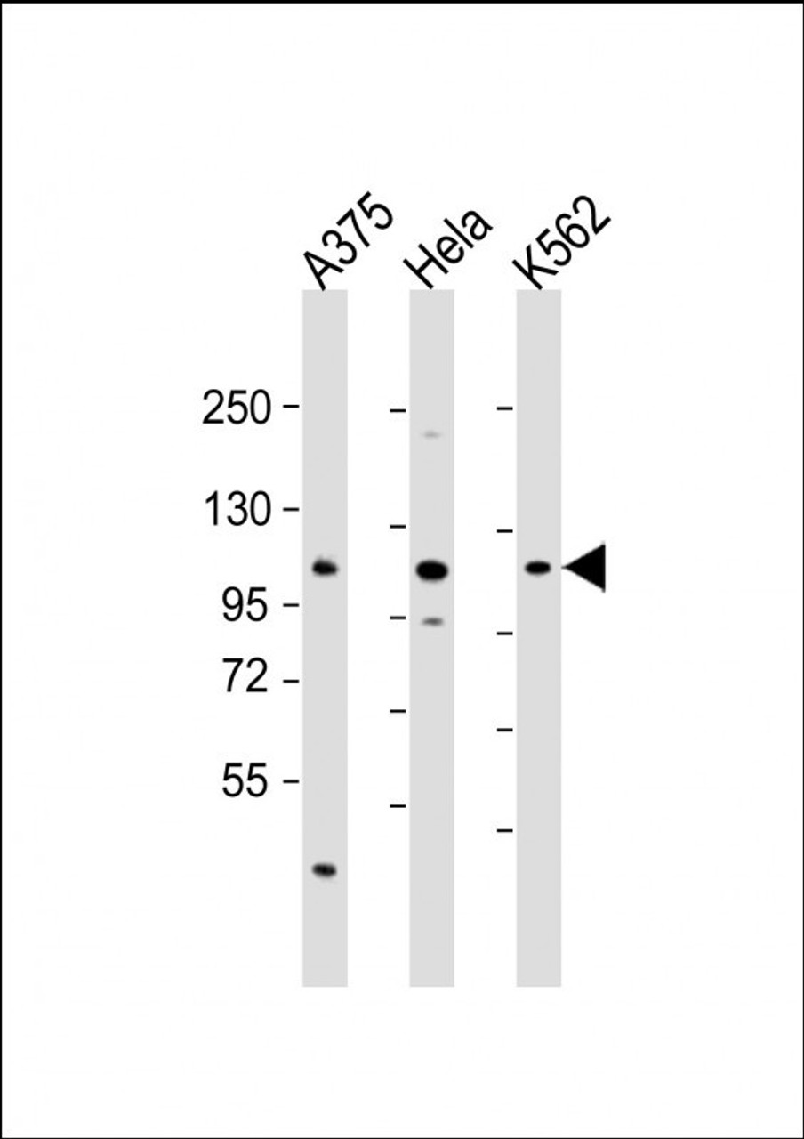 Western Blot at 1:2000 dilution Lane 1: A375 whole cell lysate Lane 2: Hela whole cell lysate Lane 3: K562 whole cell lysate Lysates/proteins at 20 ug per lane.