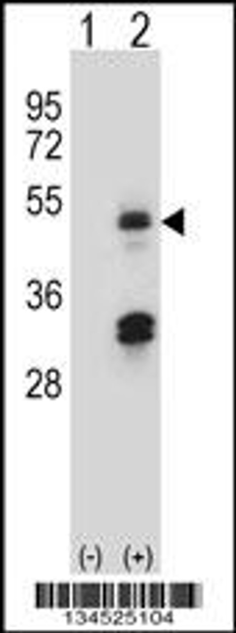 Western blot analysis of HAT1 using rabbit polyclonal HAT1 Antibody using 293 cell lysates (2 ug/lane) either nontransfected (Lane 1) or transiently transfected (Lane 2) with the HAT1 gene.