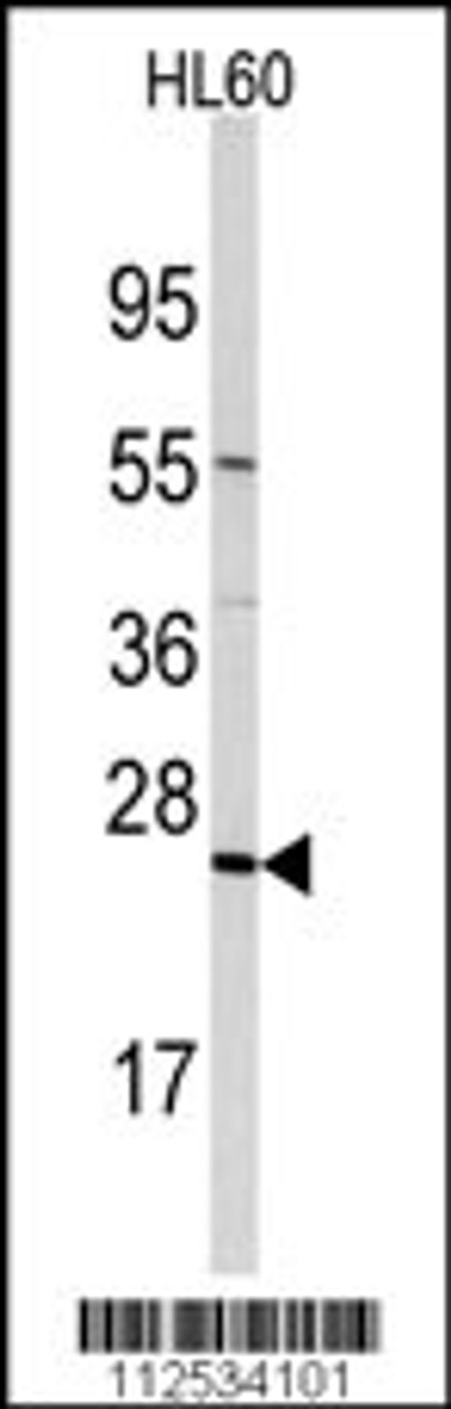 Western blot analysis of anti-TRAPPC4 Antibody in HL60 cell line lysates (35ug/lane)