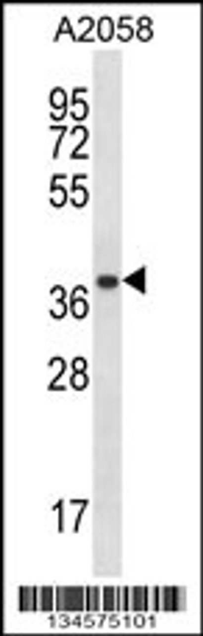 Western blot analysis in A2058 cell line lysates (35ug/lane) .