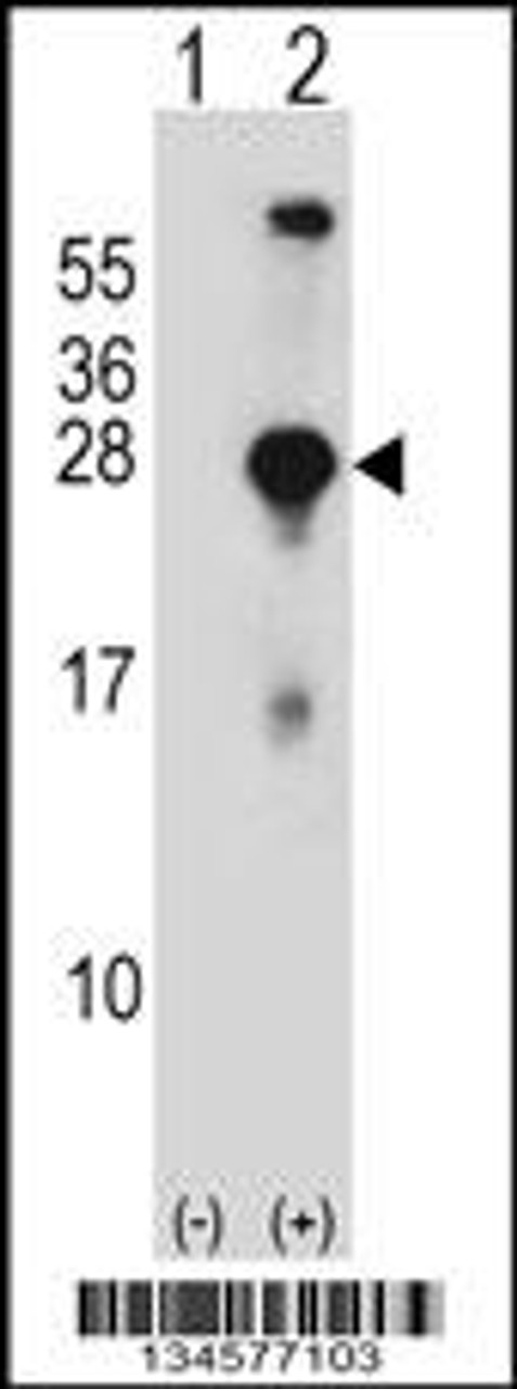 Western blot analysis of SNAP23 using rabbit polyclonal SNAP23 Antibody using 293 cell lysates (2 ug/lane) either nontransfected (Lane 1) or transiently transfected (Lane 2) with the SNAP23 gene.