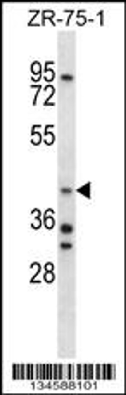 Western blot analysis in ZR-75-1 cell line lysates (35ug/lane) .