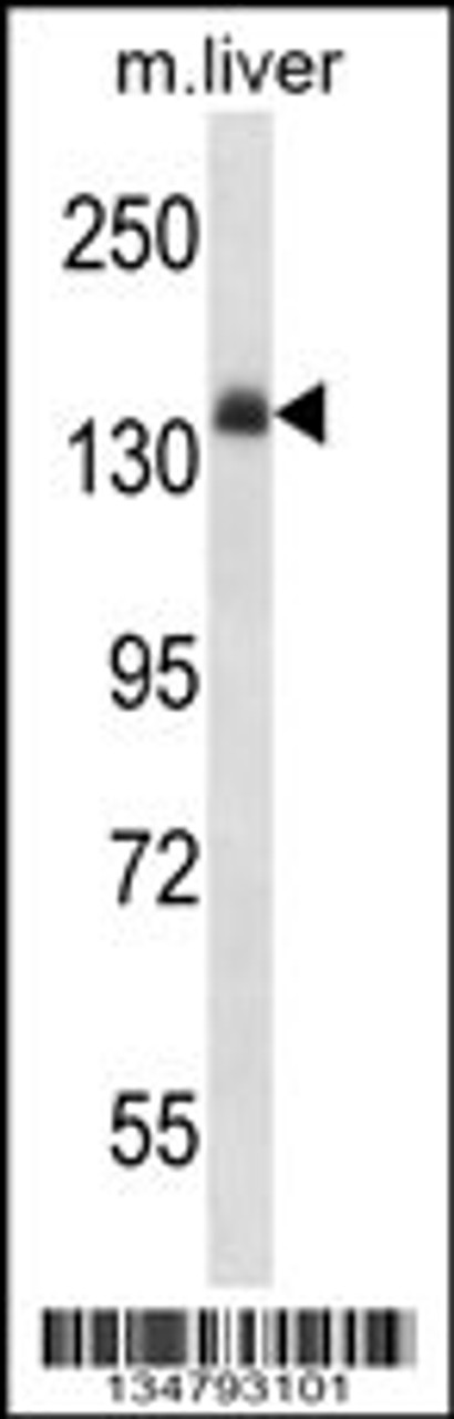 Western blot analysis in mouse liver tissue lysates (35ug/lane) .