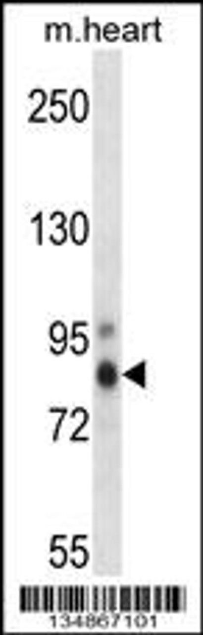 Western blot analysis in mouse heart tissue lysates (35ug/lane) .