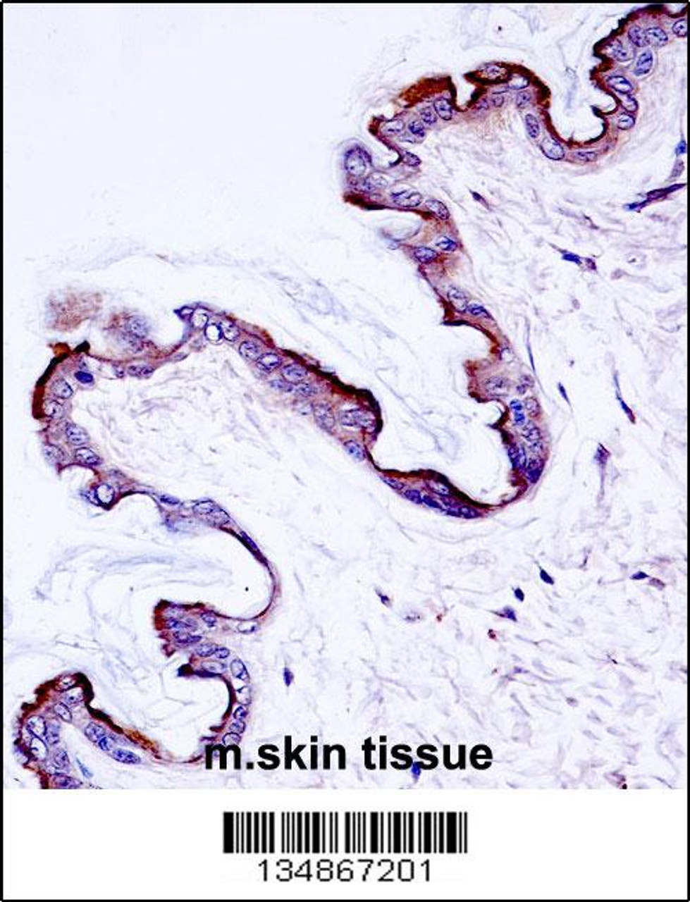 Mouse Prkch Antibody immunohistochemistry analysis in formalin fixed and paraffin embedded mouse skin tissue followed by peroxidase conjugation of the secondary antibody and DAB staining.