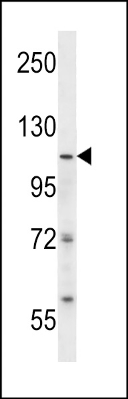 Western blot analysis in SK-BR-3 cell line lysates (35ug/lane) .