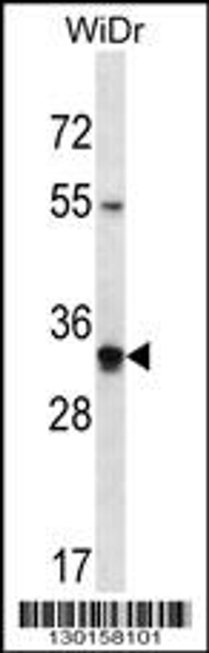 Western blot analysis in WiDr cell line lysates (35ug/lane) .