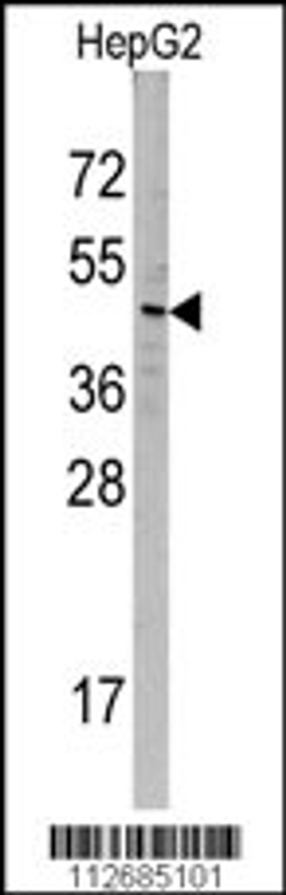 Western blot analysis of SNX6 Antibody in HepG2 cell line lysates (35ug/lane)