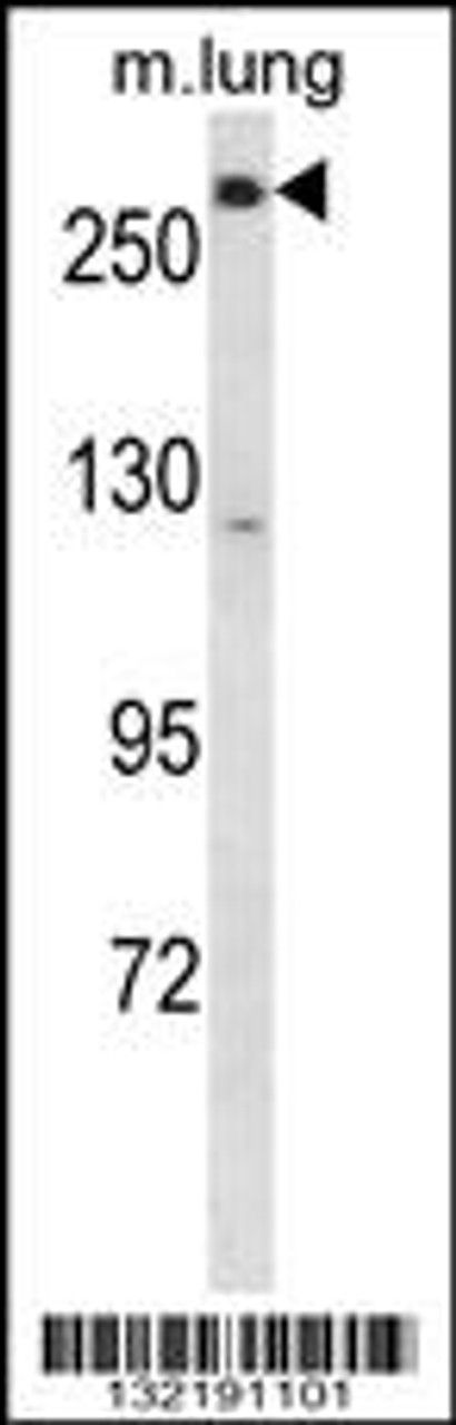 Western blot analysis in mouse lung tissue lysates (35ug/lane) .