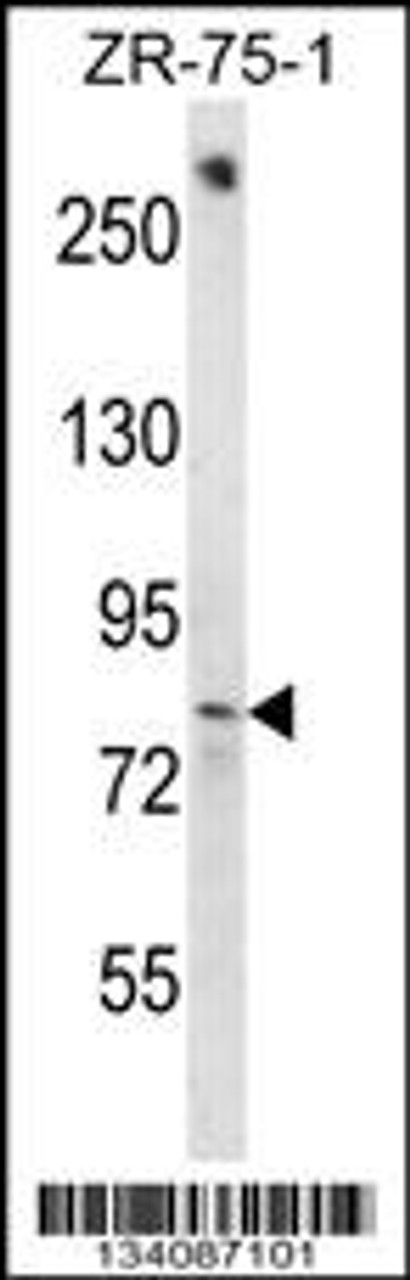 Western blot analysis in ZR-75-1 cell line lysates (35ug/lane) .