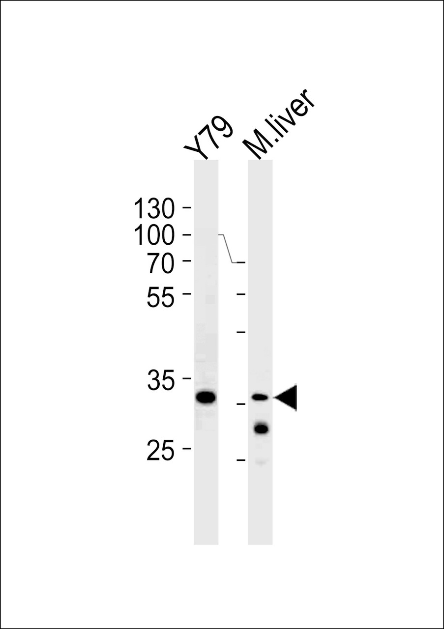 Western blot analysis in Y79 cell line and mouse liver lysates (35ug/lane) .