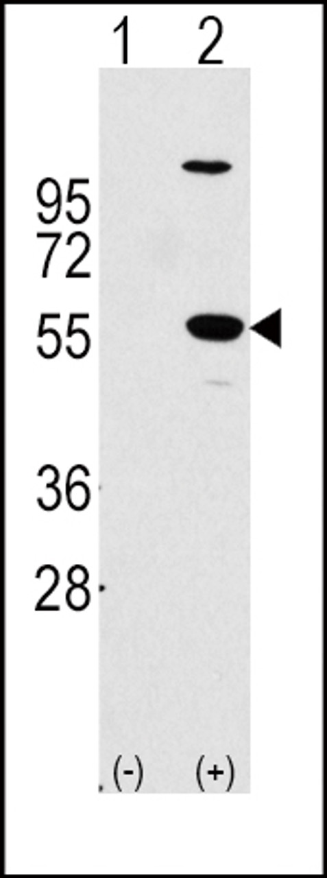 Western blot analysis of ALDH1A1 using rabbit polyclonal ALDH1A1 Antibody using 293 cell lysates (2 ug/lane) either nontransfected (Lane 1) or transiently transfected with the ALDH1A1 gene (Lane 2) .
