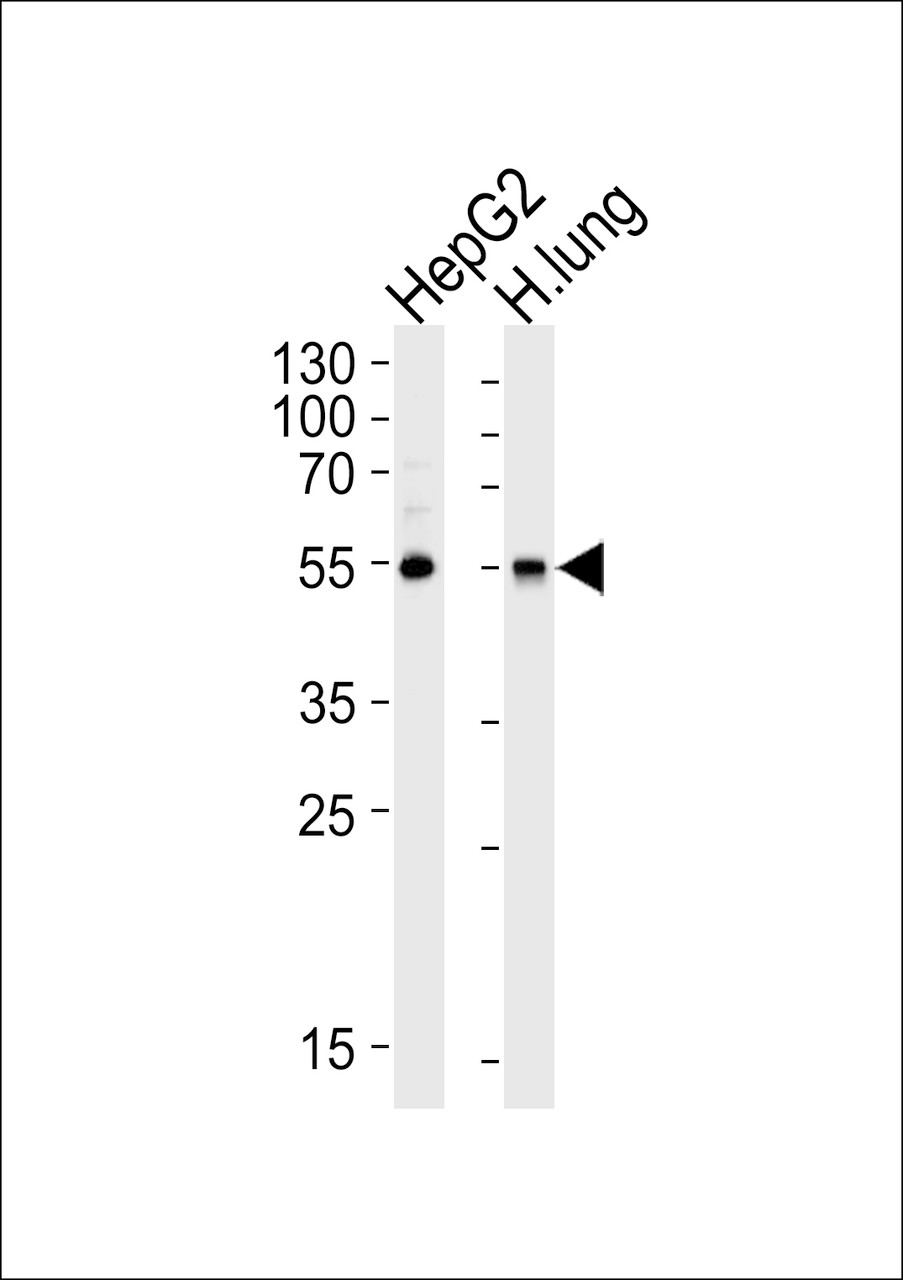 Western blot analysis of lysates from HepG2 cell line and human lung tissue lysate (from left to right) , using ALDH1A1 Antibody at 1:1000 at each lane.