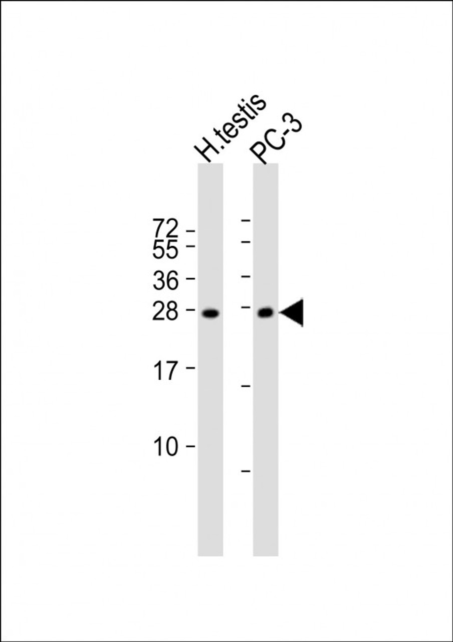 Western Blot at 1:1000 dilution Lane 1: human testis lysate Lane 2: PC-3 whole cell lysate Lysates/proteins at 20 ug per lane.