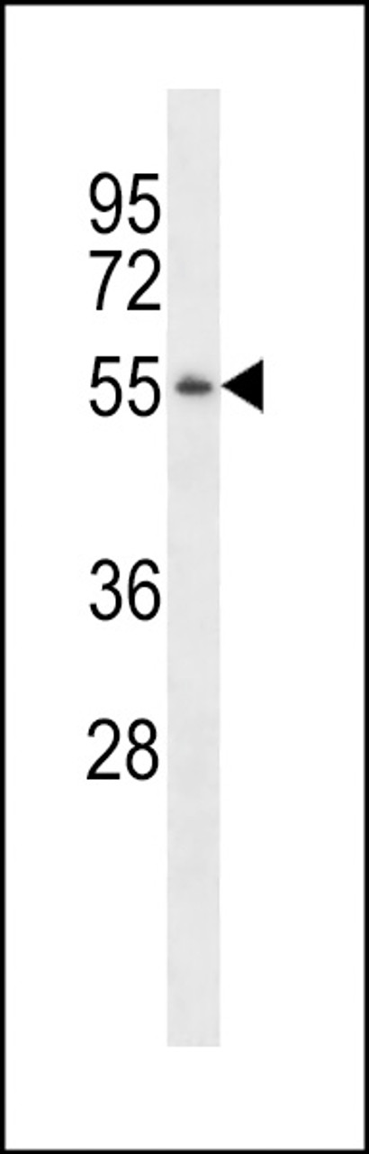 Western blot analysis in MDA-MB231 cell line lysates (35ug/lane) .