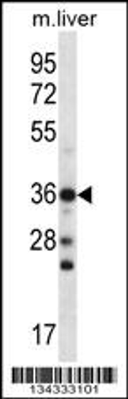 Western blot analysis in mouse liver tissue lysates (35ug/lane) .