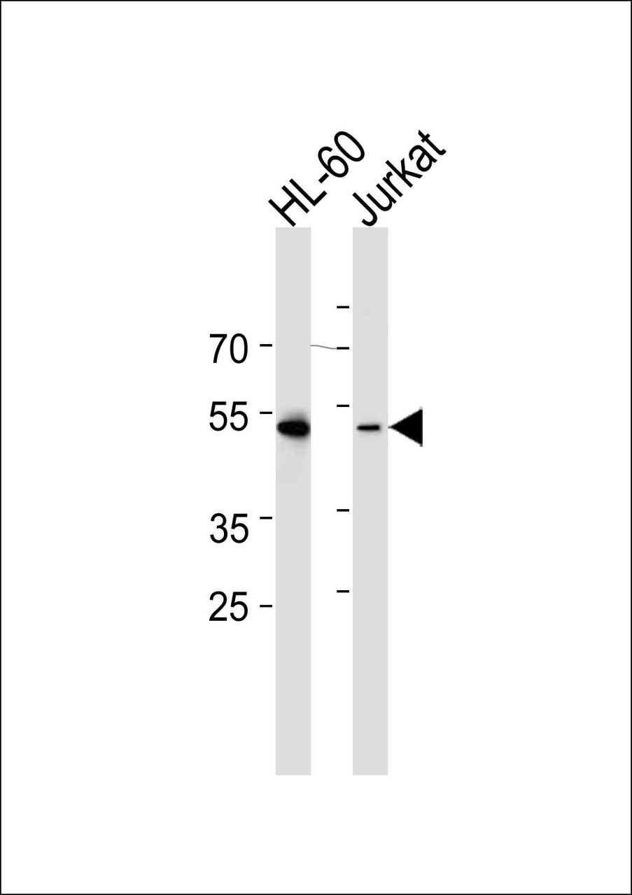 Western blot analysis of lysates from HL-60, Jurkat cell line (from left to right) , using RUNX3 Antibody at 1:1000 at each lane.