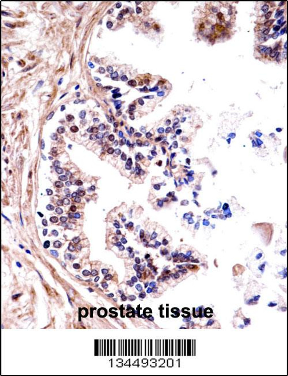 TMPRSS13 Antibody immunohistochemistry analysis in formalin fixed and paraffin embedded human prostate tissue followed by peroxidase conjugation of the secondary antibody and DAB staining.