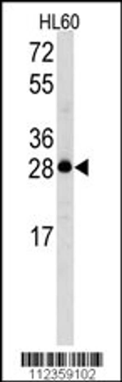 Western blot analysis of Latexin Antibody in HL60 cell line lysates (35ug/lane)