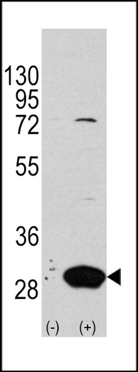 Western blot analysis of Latexin using rabbit polyclonal Latexin Antibody using 293 cell lysates (2 ug/lane) either nontransfected (Lane 1) or transiently transfected with the LXN gene (Lane 2) .