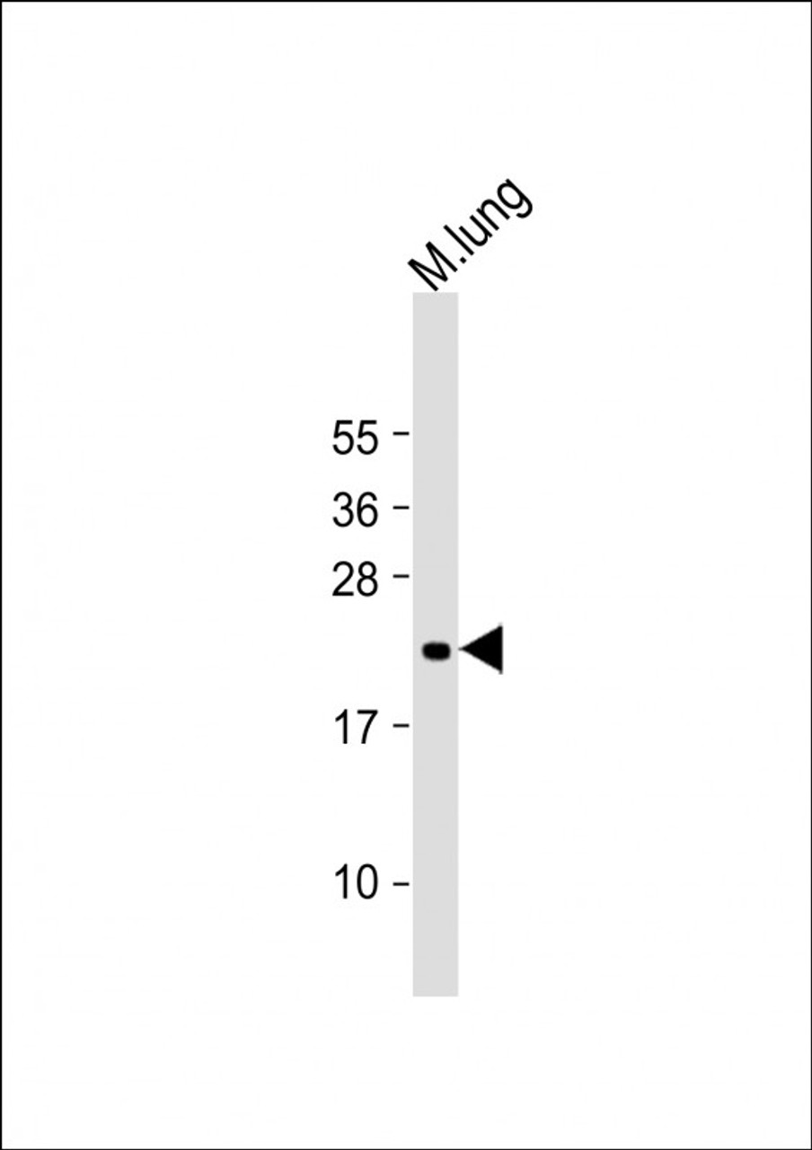 Western Blot at 1:2000 dilution + mouse lung lysate Lysates/proteins at 20 ug per lane.