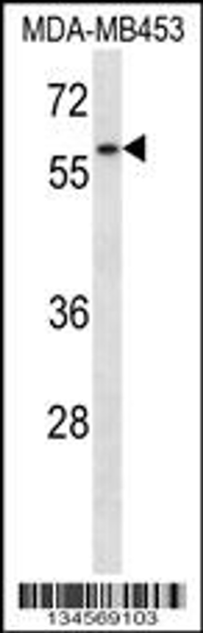 Western blot analysis in MDA-MB453 cell line lysates (35ug/lane) .