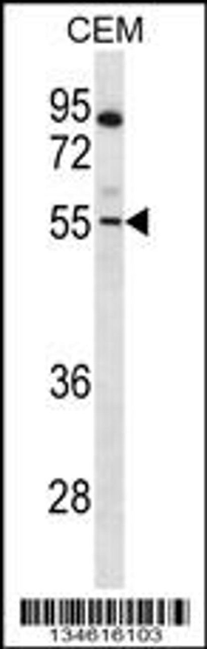 Western blot analysis in CEM cell line lysates (35ug/lane) .