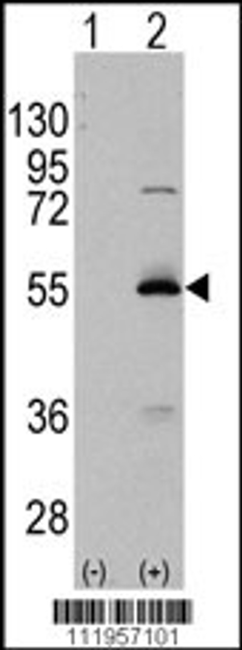 Western blot analysis of ALDH6A1 using rabbit polyclonal ALDH6A1 Antibody using 293 cell lysates (2 ug/lane) either nontransfected (Lane 1) or transiently transfected with the ALDH6A1 gene (Lane 2) .