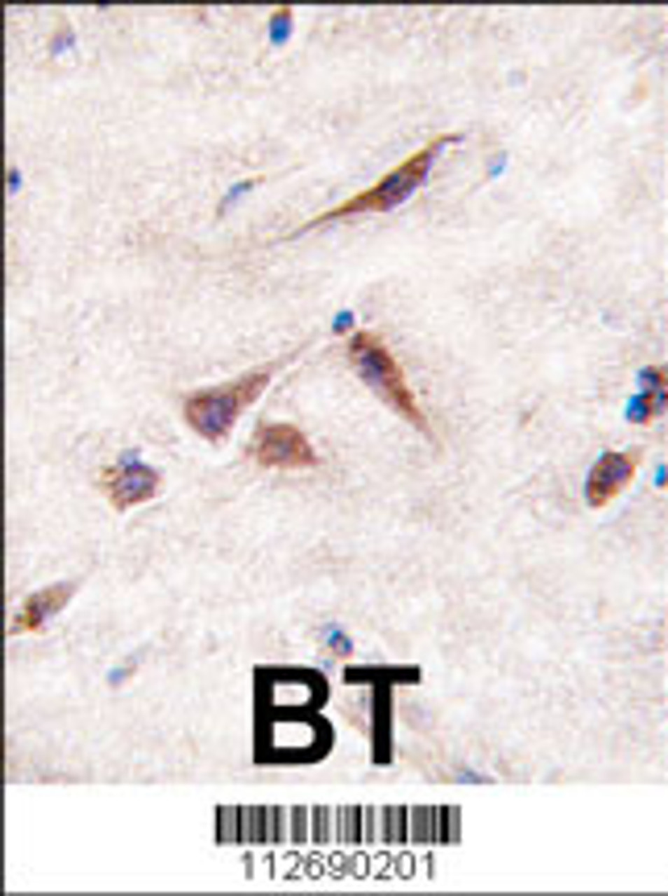 Formalin-fixed and paraffin-embedded human brain tissue reacted with ERAS antibody (A28) , which was peroxidase-conjugated to the secondary antibody, followed by DAB staining.