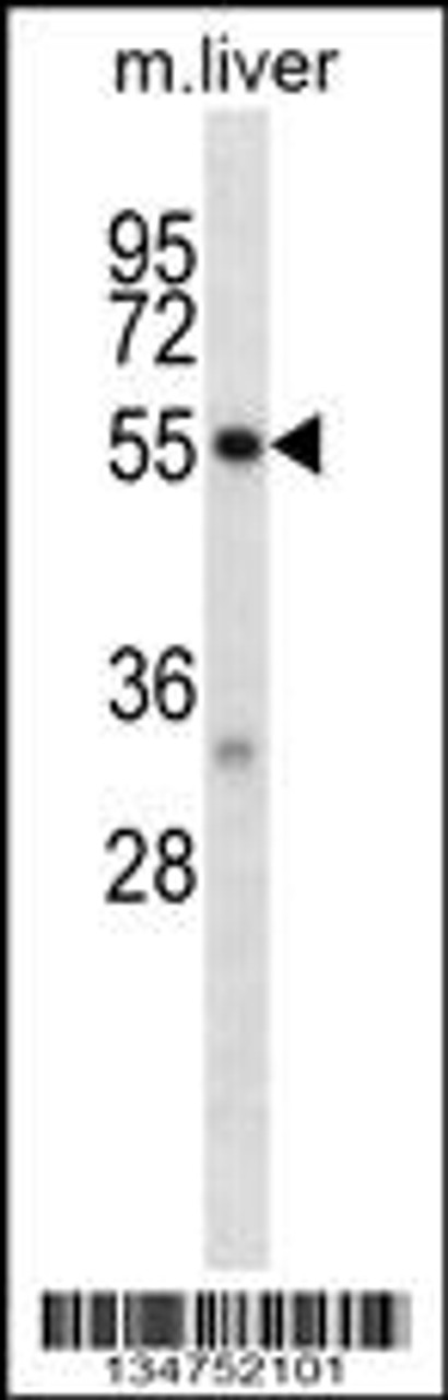 Western blot analysis in mouse liver tissue lysates (35ug/lane) .